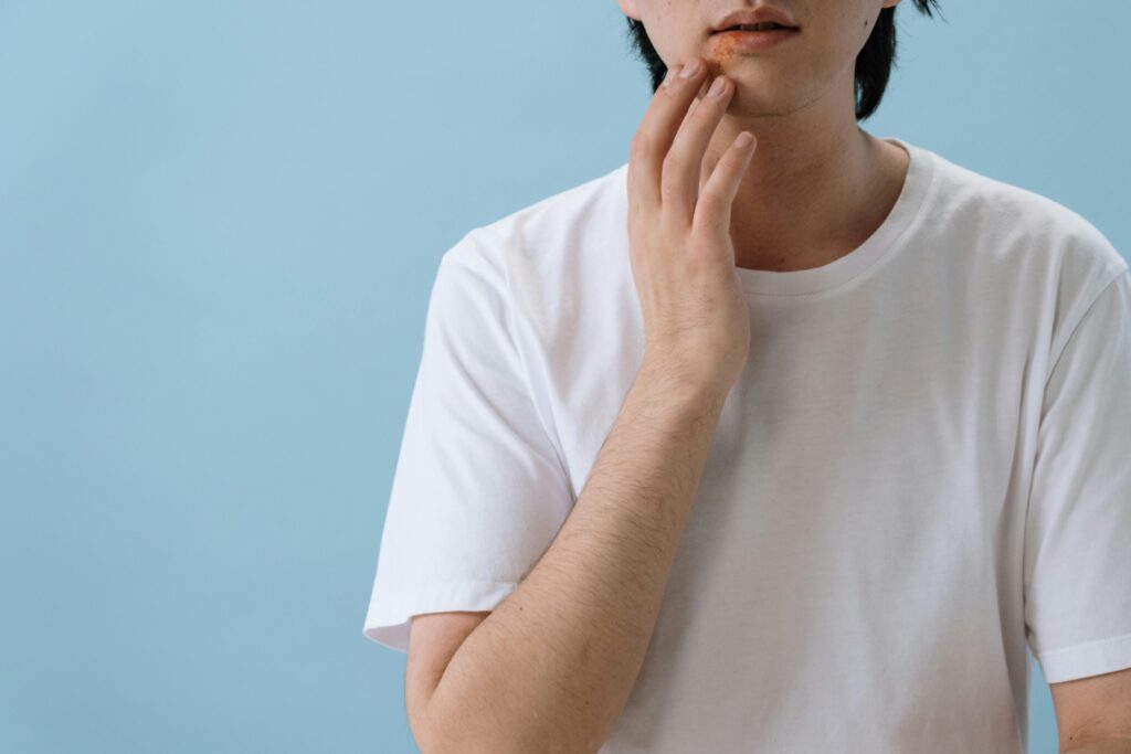 pexels-photo-5712685-5712685 Close-up of a man touching his face showing signs of a skin condition or allergy.