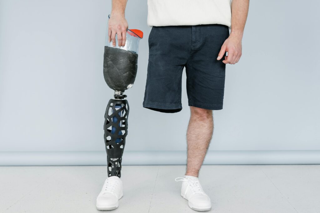 Close-up of a man with a prosthetic leg wearing casual shorts, showcasing modern prosthetic technology.